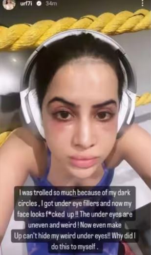 Uorfi Javed Instagram Story 